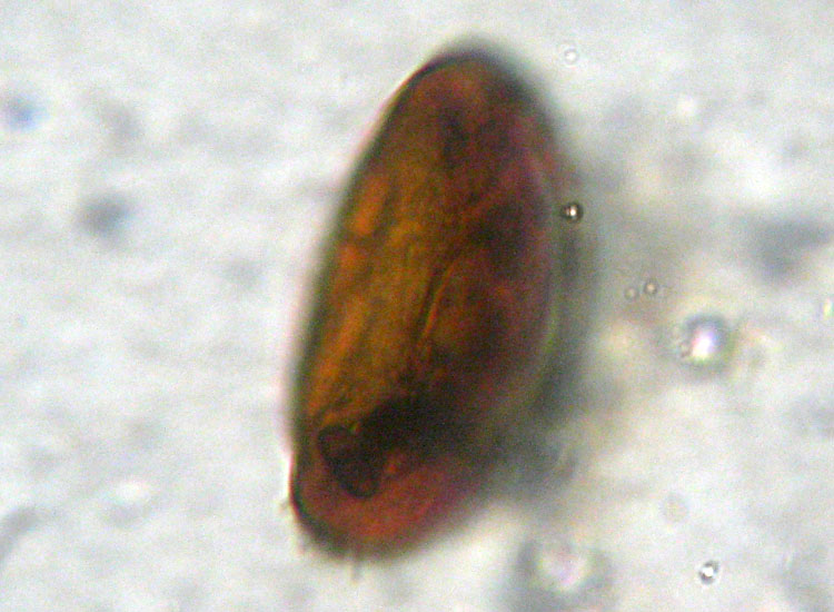 Arcella vulgaris
